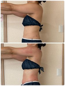 頑張ってるのに痩せない人、実は「痩せる前の準備」ができていないかも？のイメージ